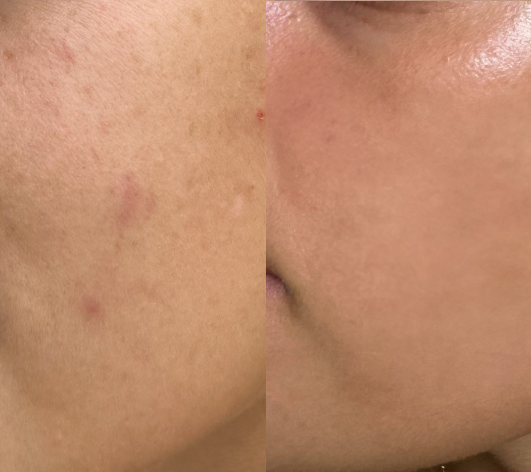 Before and After shot of how the product improves skins to healthy