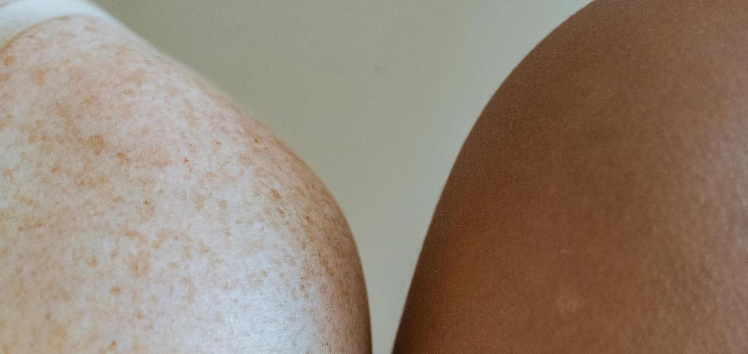 Skin Cancer Early Detection Guide: How to Do a Proper Skin Self-Exam